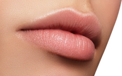 Lippenunterspritzung – Lippen “aufspritzen”